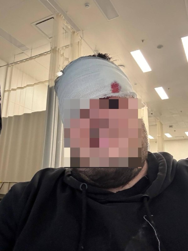 Кусок лепнины упал на голову пассажира на станции «Комсомольская»Массивный фрагмент потолочной конструкции обрушился прямо на пассажира
